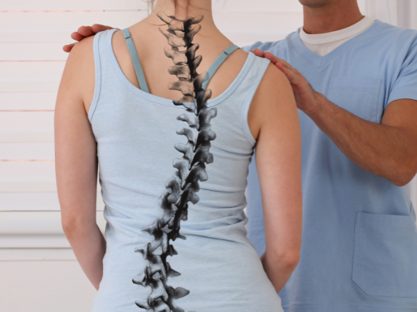 Can a Chiropractor Help with Scoliosis?