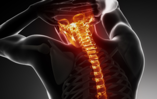 Spinal Alignment Mistakes