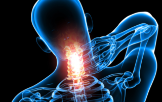 Holistic Treatment Options for Neck Pain